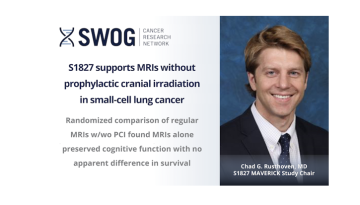 S1827 supports MRIs without PCI in SCLC